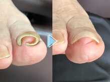 ネイルメディックス 宇都宮店