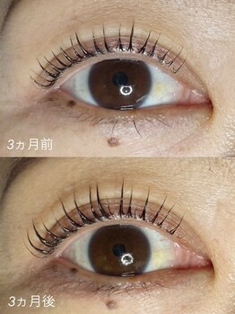 エーラッシュ(A-Lash)/まつげが伸びるビフォーアフター