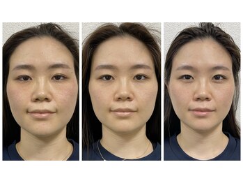 ハレハナ 渋谷駅前店(Hare-Hana)/ブライダルエステ整体の効果