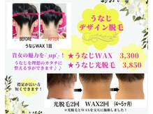 ブリリアンス(BRILLIANCE)/☆うなじデザイン脱毛☆