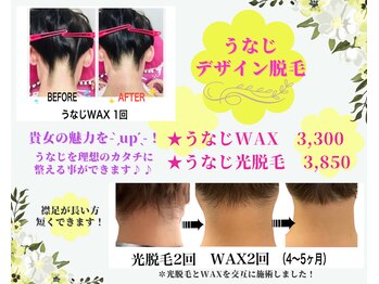 ブリリアンス(BRILLIANCE)/☆うなじデザイン脱毛☆