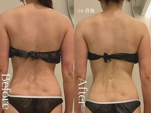 ユーフォリア グロウ(euphoria glow)/｛　ラフォス90分×EMS15回　　}