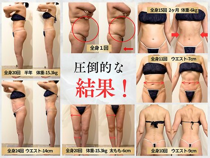 クレンズ(CLeanse)の写真