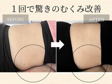 サロンドエスキー(Salon de SKey)/リンパマッサージ1回の効果