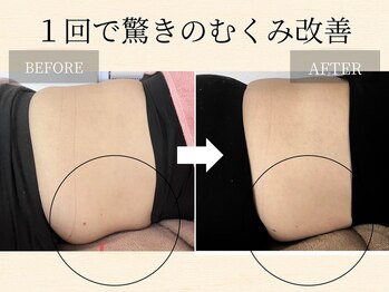 サロンドエスキー(Salon de SKey)/リンパマッサージ1回の効果