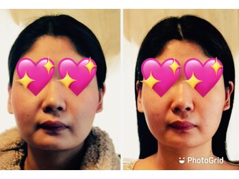 エンドリングフェイシャル専門サロン ムーンティア/小顔矯正リフトアップヘッドスパ