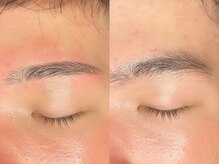 アイクイック 那覇国際通り店(Ai Quick)/眉毛/メンズ/那覇/眉毛サロン/眉