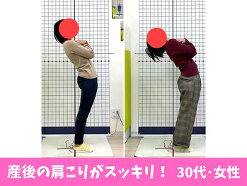 にしぐち鍼灸整骨院 玉串院/産後の肩こりスッキリ…30代女性