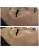 ラヴィソンファム(Ravissant femme)/40代1回効果/ハリ/ツヤ