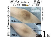 美肌研究所 東京新宿支店