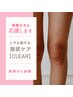 【保育士さん応援】ヒザの黒ずみ集中ケア《CLEAR》1回の施術で長期持続◎