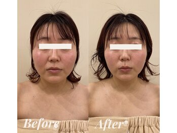 シェリール(Cherir)