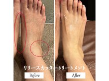 リノ(Lino)/下半身リリースカッター