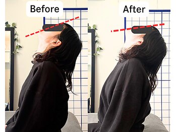 整体院 爽良/【札幌/大通り】首肩こり