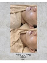 コンクパール(CONCH PEARL.)/リフティングプロ