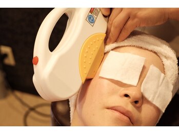 ヌーボ(NUeVo)/顔脱毛35分6000円