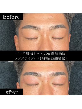 ユー 西船橋店(you)/ビフォーアフターお写真