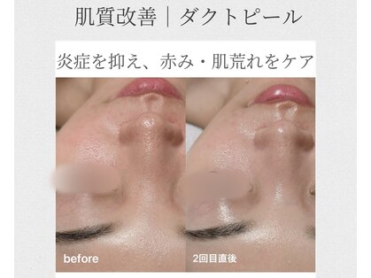 オンド(OND)の写真