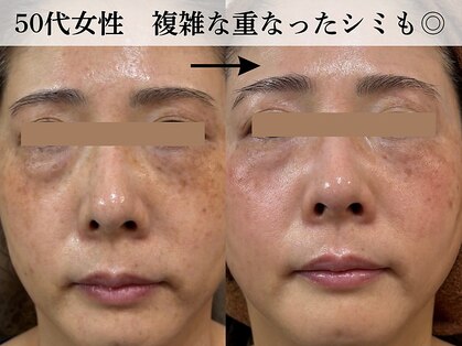 ジューンブライド(June Bride 61)の写真
