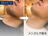 【新規】メンズ/ヒゲ脱毛｜完全都度払い制