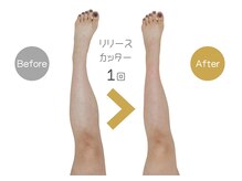 セレンディピティー(Serendipity)の雰囲気（むくみだけでなく、脚の使い癖まで整えてスッキリ！）