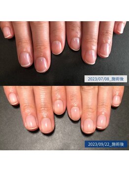 ブラン(blanc)/2.自爪育成