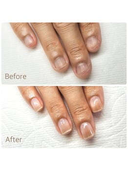 最強ネイル　モニター募集