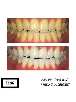 レオン 磐田(REON)/◇ お客様 before＆after ◇