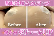 リーズリアン(Rises Lien)
