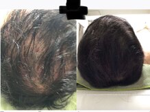 キヨラビューティーの雰囲気（頭皮ケア/髪質改善/近赤外線/幹細胞培養上清液）