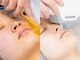 フェミソワン(FemiSoin)の写真/【VIO光脱毛(口ヒゲの脱毛付き)￥8,800】輝く素肌を実現◎自信を持てる素肌に☆驚きの効果を体感ください♪