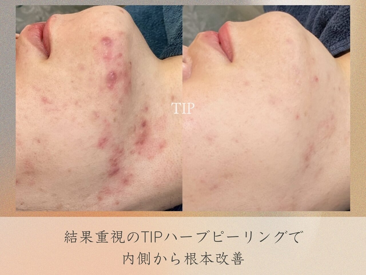 マウ(Mau)｜ホットペッパービューティー