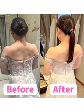 すみれ鍼灸整骨院/神戸　ブライダル美容整体