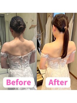 すみれ鍼灸整骨院/神戸 ブライダル美容整体