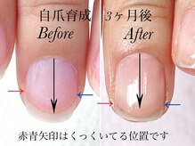トゥインクリーネイルサロン(Twinkly Nail Salon)/【地爪育成】1回お試し