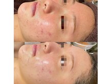 ハピネスビューティーサロン(happiness beauty salon)/