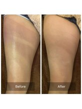 プルトア/むくみを放置しないで☆彡