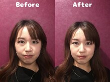 くにたちNyan鍼灸整体院/【小顔矯正】Before After 6