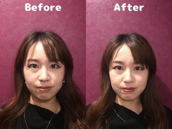 くにたちNyan鍼灸整体院/【小顔】Before After 6