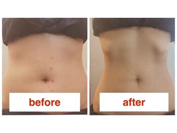 にこ。/姿勢整体×痩身エステ