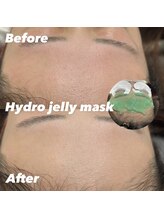 レディエント 北浦和店(Radiant)/HYDROJELLYMASK