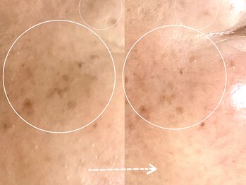 セレーノ/ビフォーアフターのご紹介