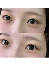 ナル(NaLu)/上下まつげパーマ