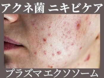 マヴィ くずは店(MavY.)/ニキビケア!