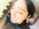 千里山わだち整骨院の写真/ニキビケア・シワたるみ改善や小顔など、お顔の血行促進でいつもの化粧水が入りやすいお肌に◎【美容鍼】