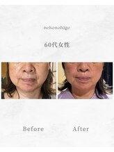 ねこのひげ/お客さんの変化