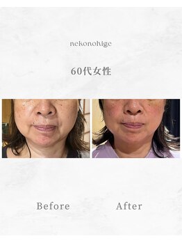 ねこのひげ/お客さんの変化