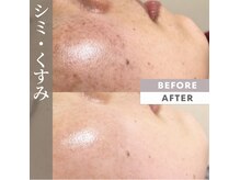 ラニウル(Laniulu)の雰囲気（毛穴/シミ/乾燥/美白/ブライダルメニューもご用意！赤羽で肌改善）