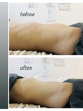 ナチュラルビューティラテ(NATURAL BEAUTY LATTE)/腸もみ