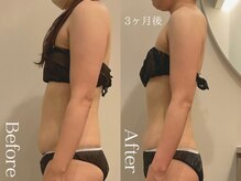 ユーフォリア グロウ(euphoria glow)/｛　ラフォス90分×EMS15回　　}